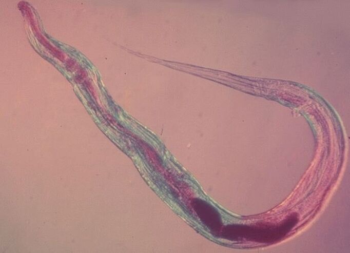 Pinworm zem mikroskopa