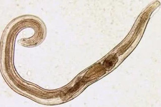 parazīti cilvēka pinworm
